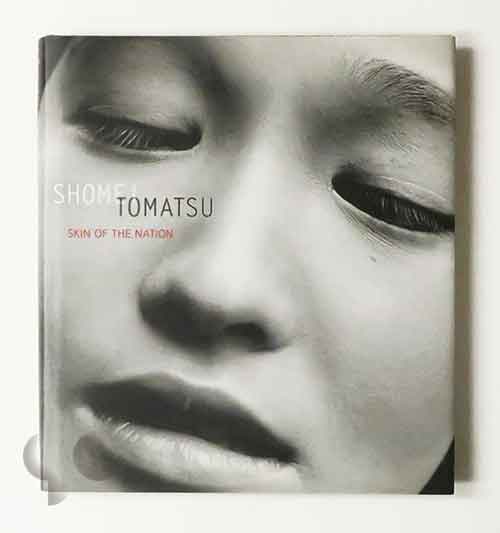 Skin of The Nation | Shomei Tomatsu