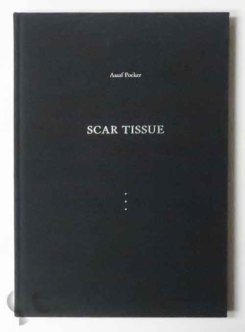 Scar Tissue | Assaf Pocker